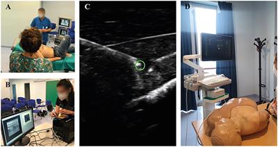 Simulation-Based Medical Education and Training Enhance Anesthesia Residents' Proficiency in Erector Spinae Plane Block